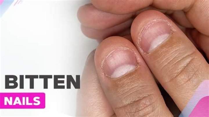 Are nail biters intelligent
