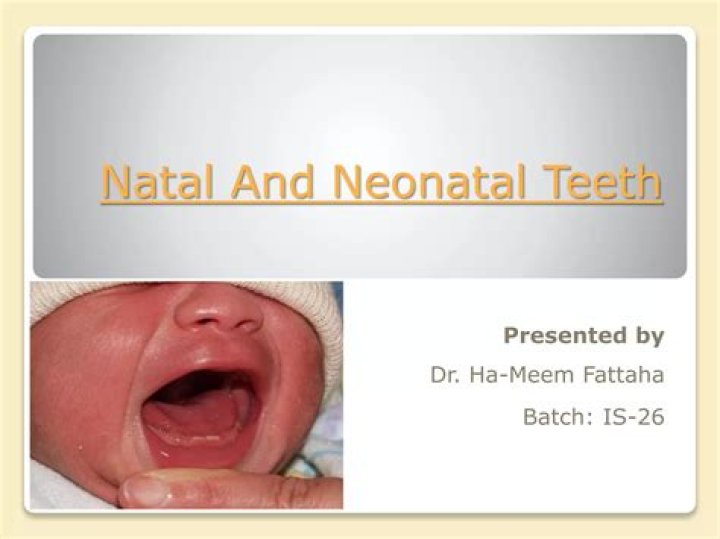 Are neonatal teeth dangerous