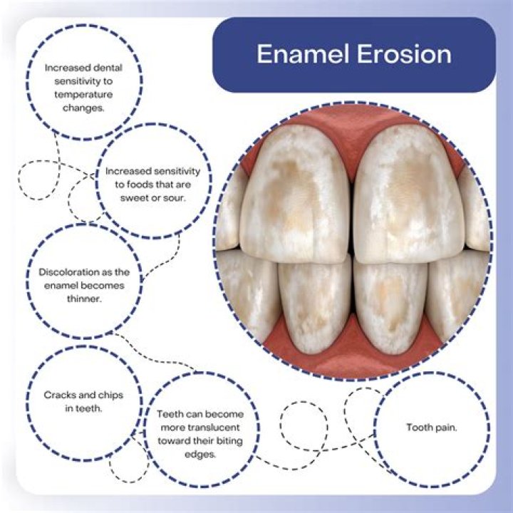 Are teeth covered in enamel