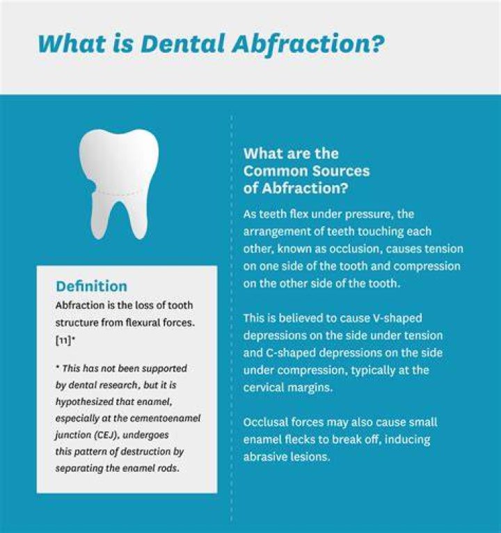 Are tooth abfractions common