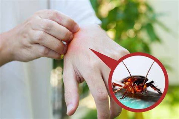 Can a cockroach bite a human