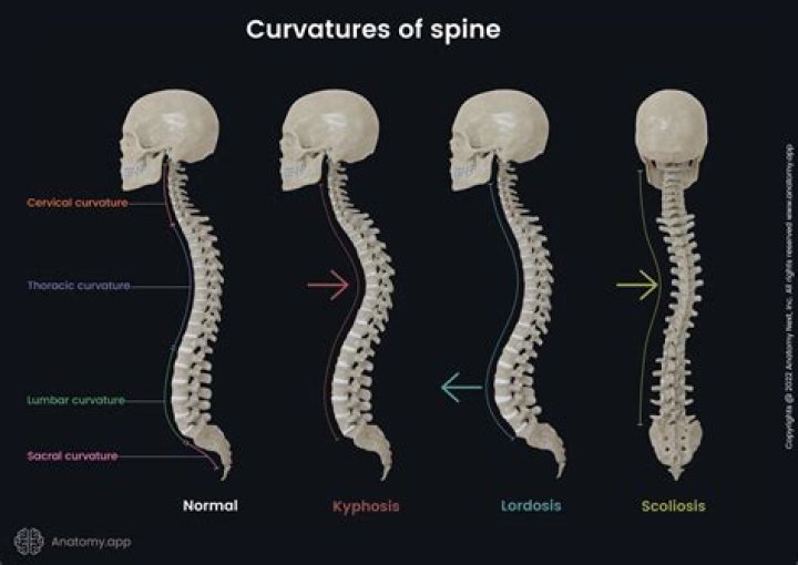 Can a twisted spine be fixed