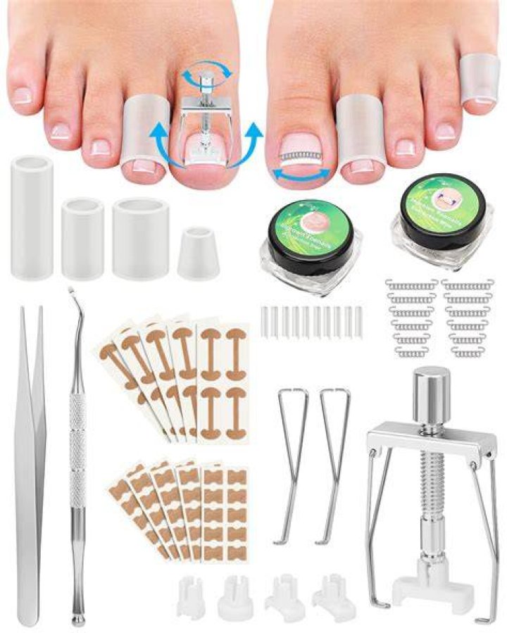 Can pincer toenails be fixed