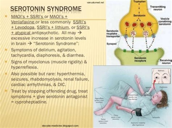 Can serotonin syndrome kill