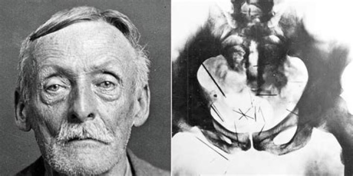 Did Albert Fish go to school