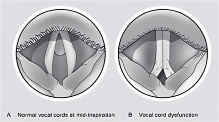 Do false vocal cords vibrate