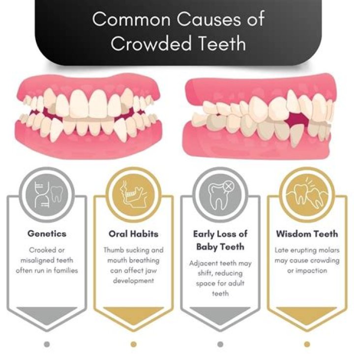 Do grills go over your teeth