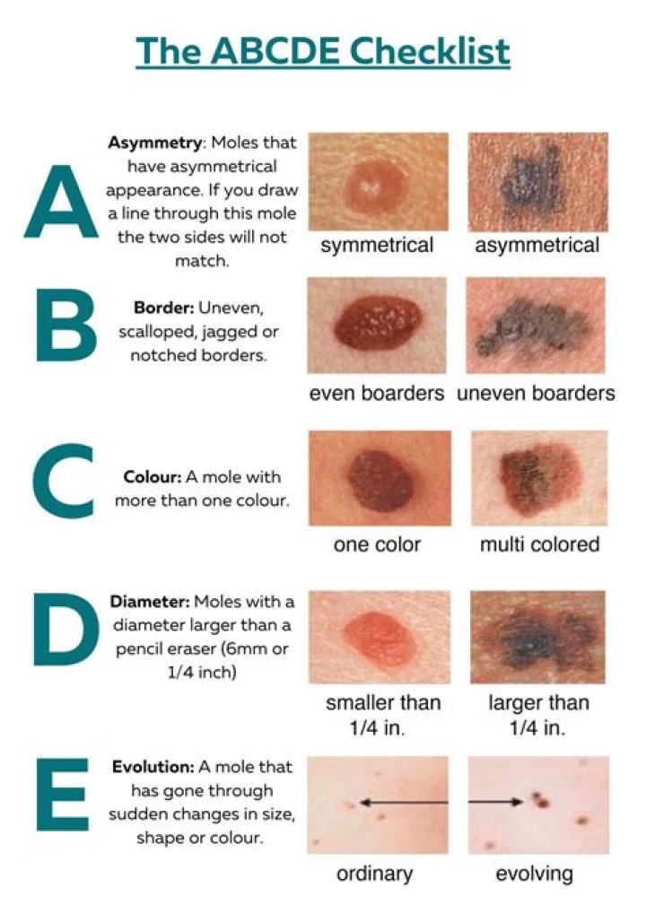 Do moles have bad eye sight