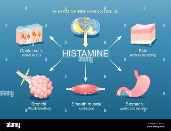 Does mast release histamine