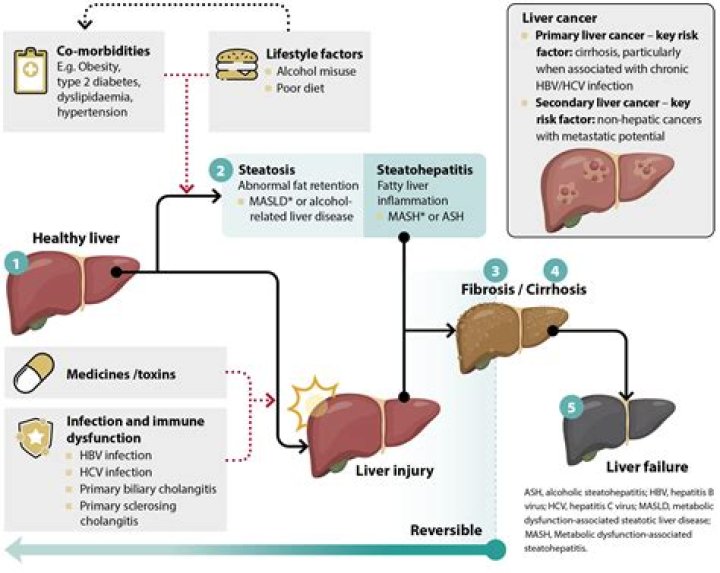 Does Pepcid affect the liver