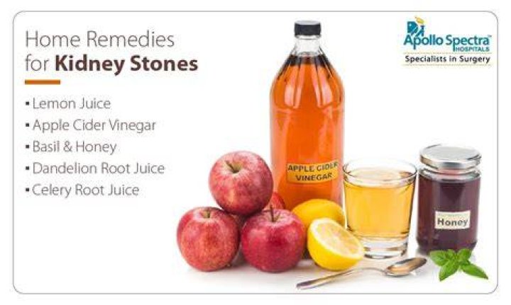Does Soda help kidney stones