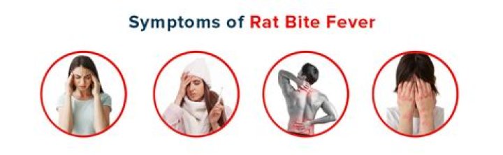 How common is rat bite fever