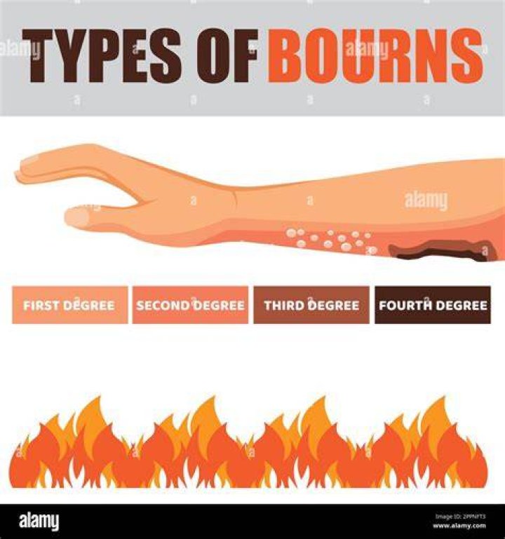 How do you burn a joss stick
