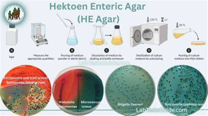 How do you identify Shigella