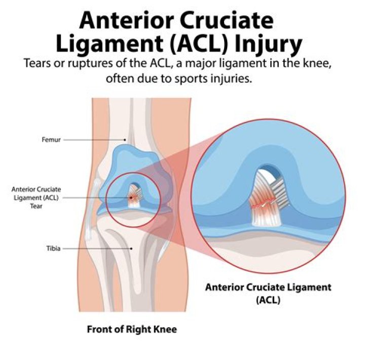 How do you treat microtrauma