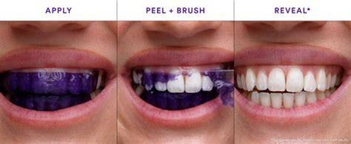 How do you use bleach strips