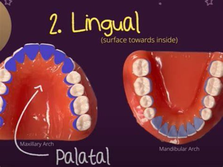 How does a lingual arch work