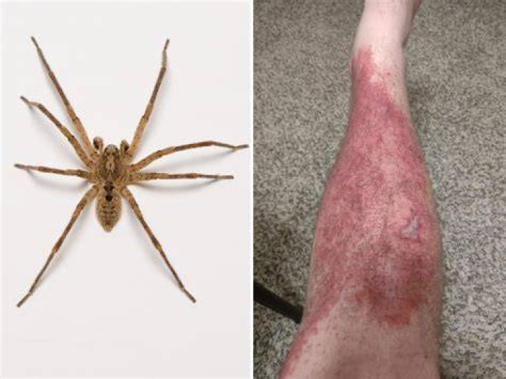 How does a spider kill a fly