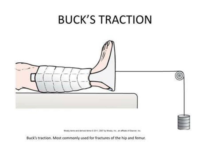 How does bucks traction work
