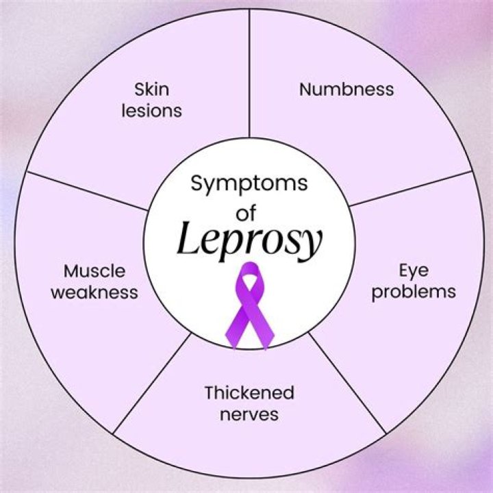 How does leprosy move around