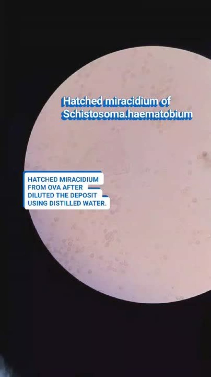 How does the miracidium move