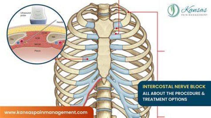 How is a trigeminal nerve block done