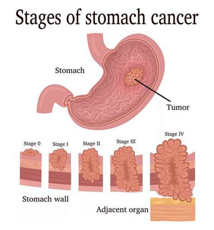 How is every cancer the same