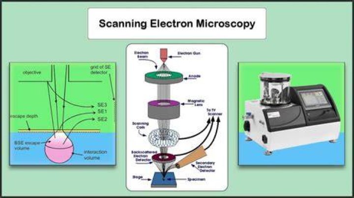 How is microscopy test done