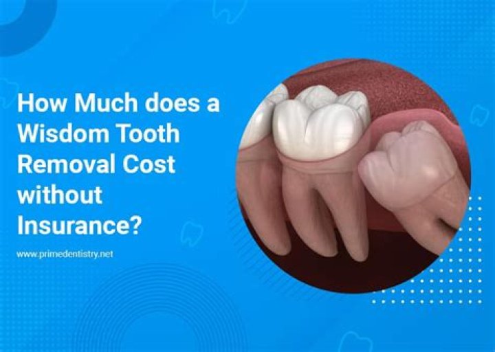 How much does it cost to get warts removed