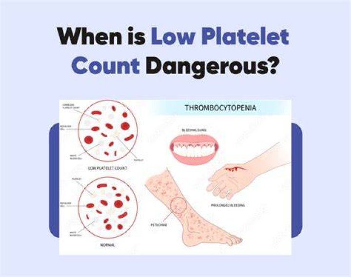 Is 127 a low platelet count