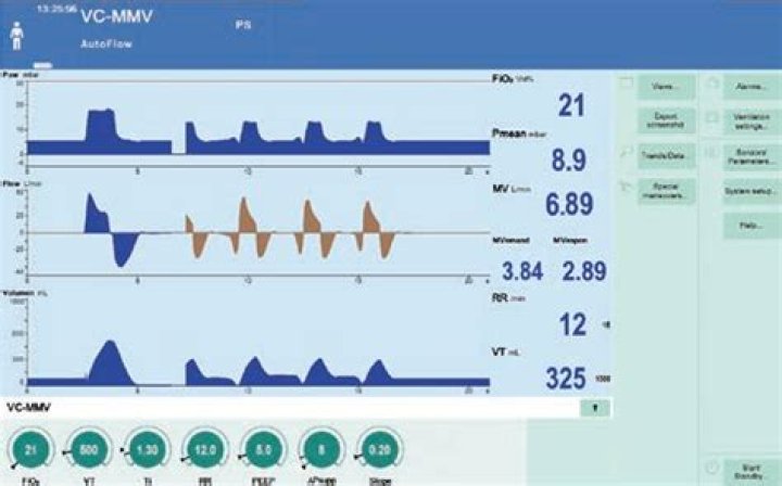 Is AutoFlow the same as PRVC