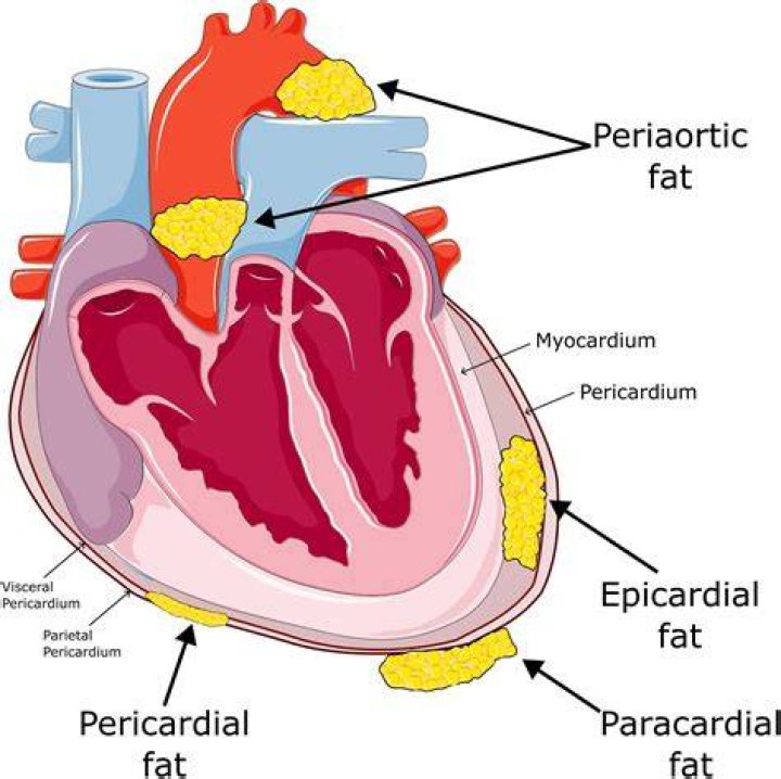 Is epicardial fat pad Normal