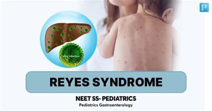 Is Reyes syndrome permanent