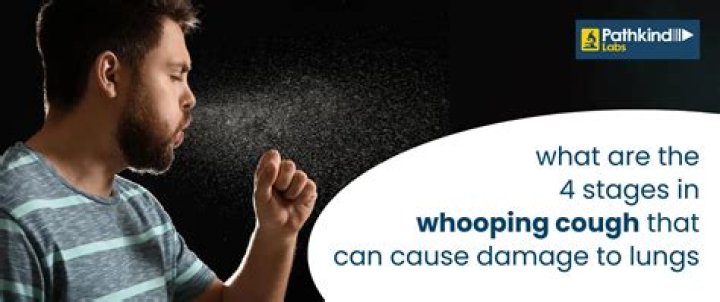 Is whooping cough common now