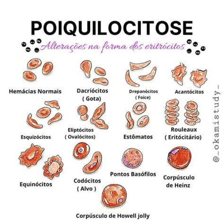 ¿Qué es la microcitosis leve
