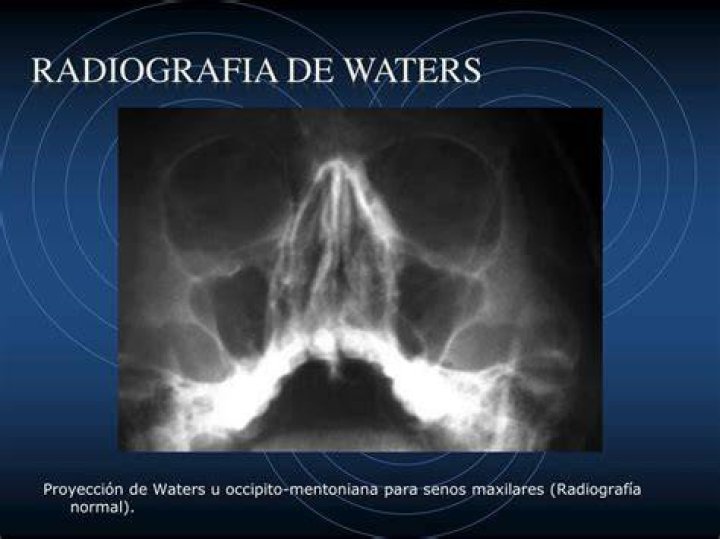 ¿Qué es la proyección de Waters