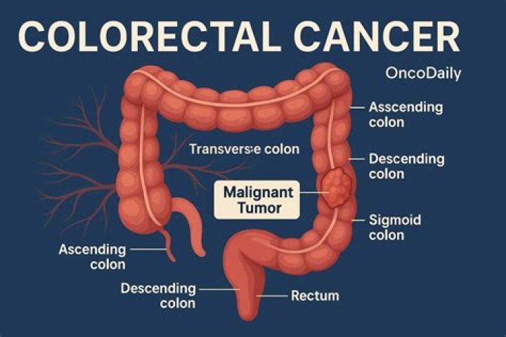 What are rectal exams called