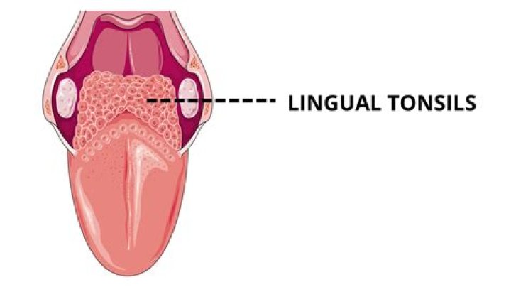 What are the lingual tonsils