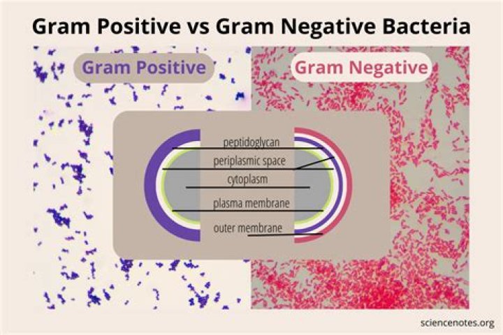 What can stain gram variable