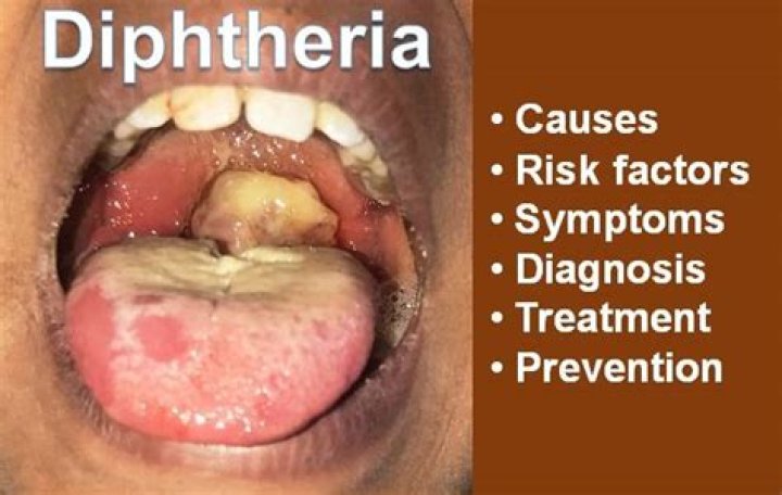 What causes black diphtheria