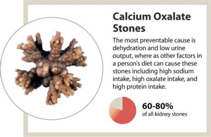 What causes calcium oxalate