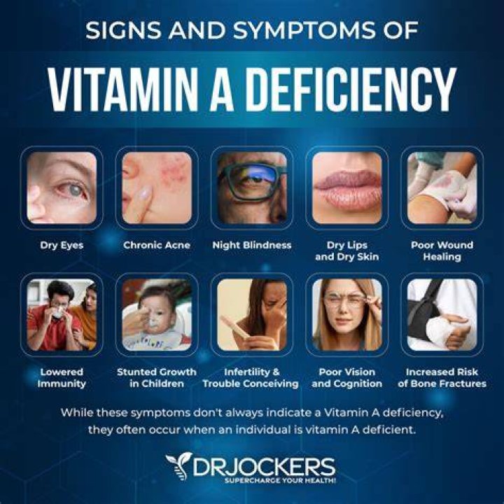 What causes Vit A deficiency
