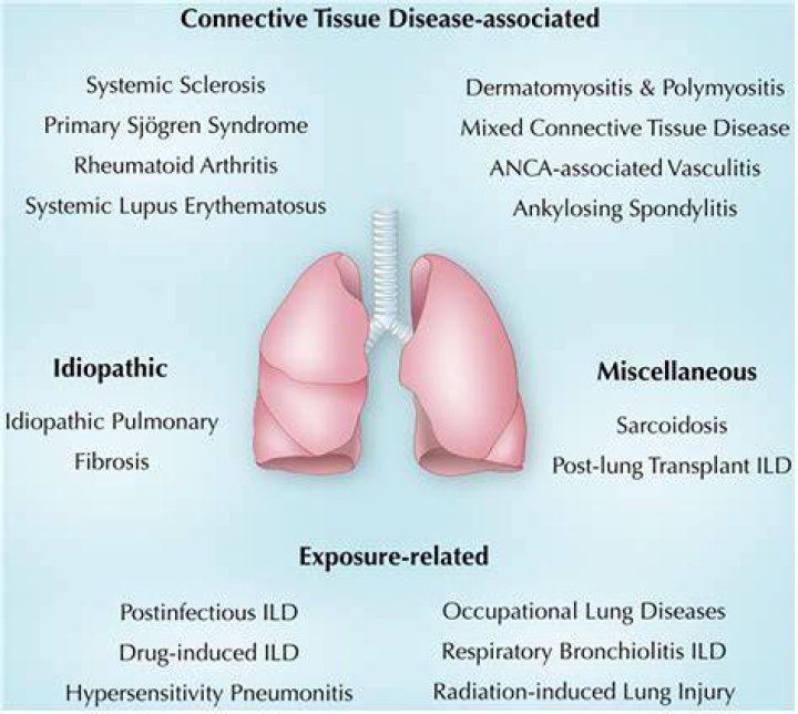 What diseases cause crepitus