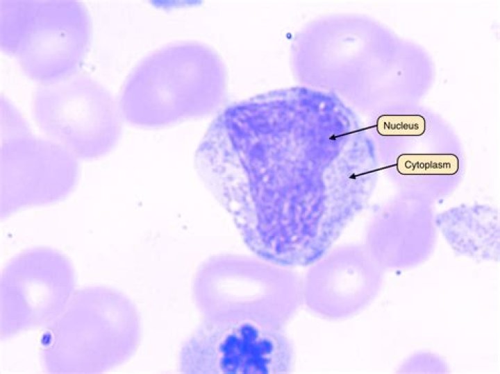 What do blast cells indicate