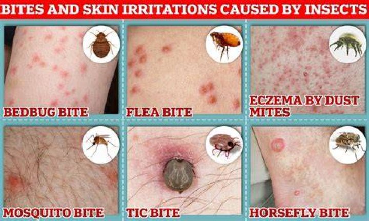 What do bugs inject you with