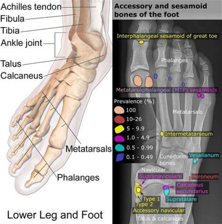 What do foot x rays look for