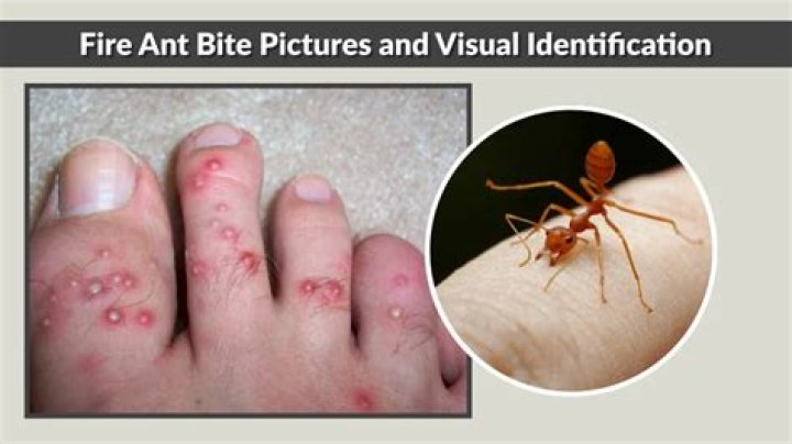What does ant bite look like