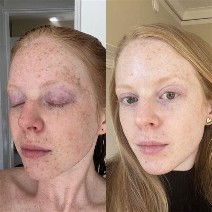 What does Aveda exfoliant do