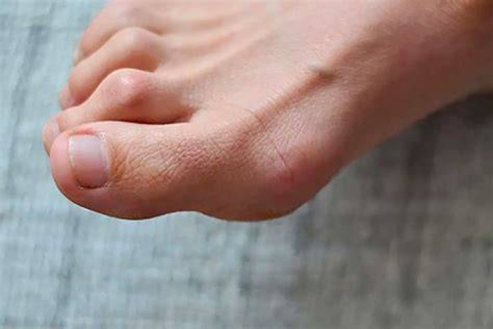 What does each toe represent