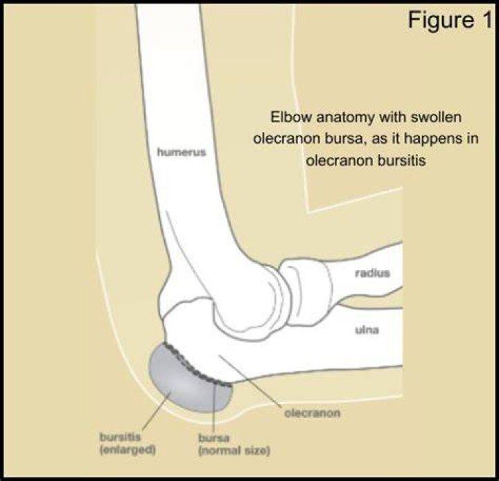 What does elbow packing mean